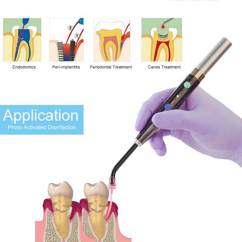Wireless F3WW Dental Diode Las - Diode Laser Module review and price